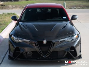Alfa Romeo Giulia GTAm Style Front Fenders - Carbon Fiber - Raw Finish